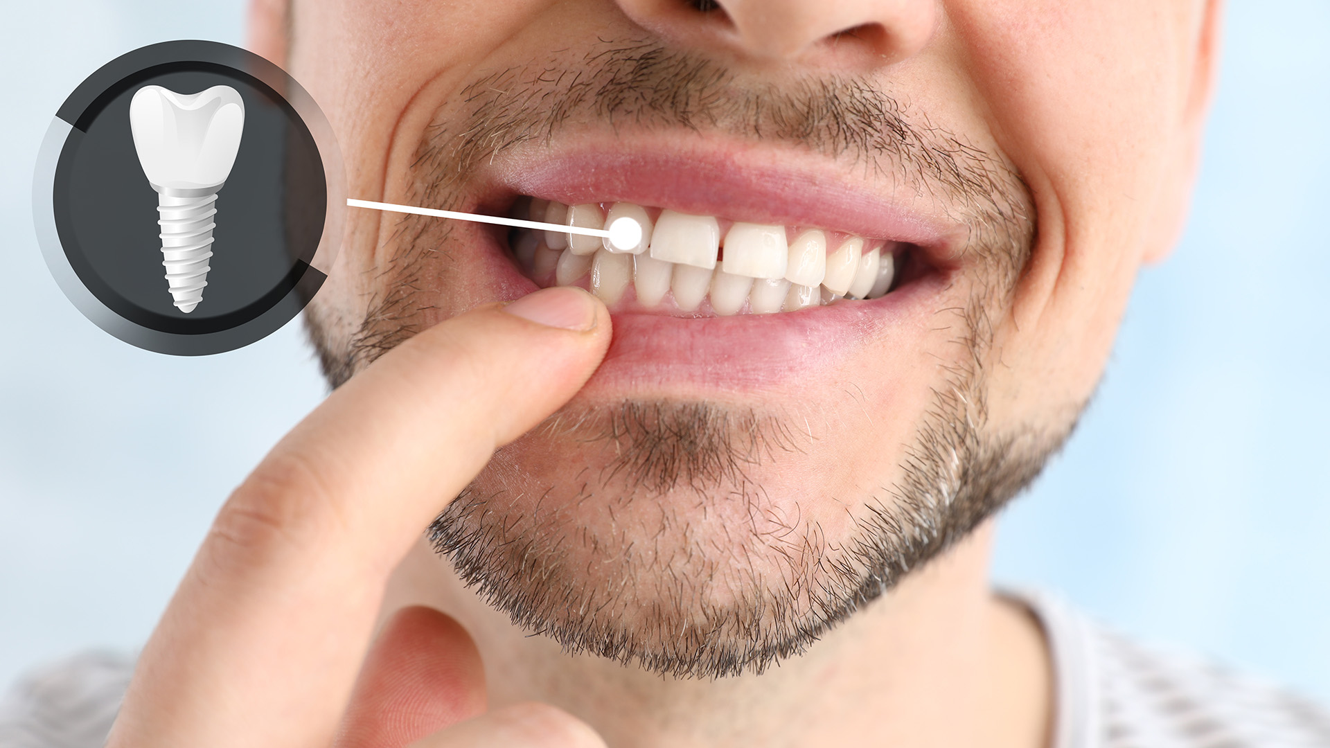 Oral Surgery Fayetteville, AR