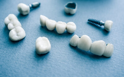 Dental Implants vs. Dentures: Choosing the Best Option for Your Smile