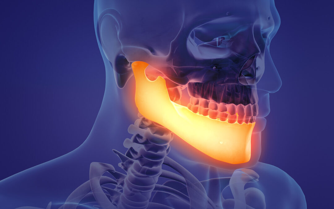 Why You May Need Jaw Surgery