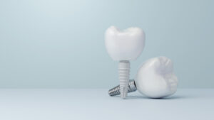 Explore Your Dental Implant Options