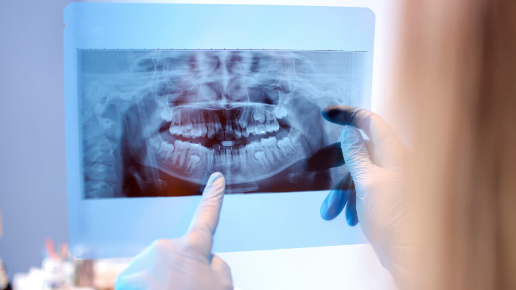 signs you need oral surgery now