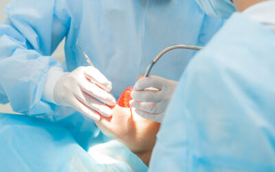 Is Oral Surgery Covered by Medical or Dental Insurance?