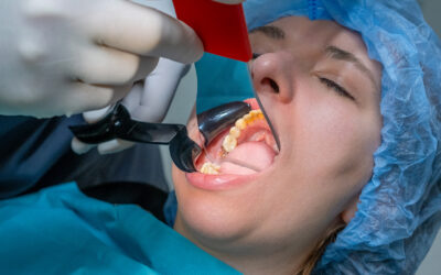 Multiple Dental Extractions at Once: What to Expect and How to Prepare
