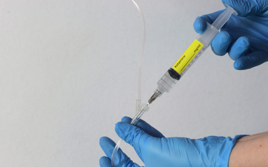 How Intravenous Anesthesia Sedation Works
